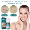 Instant ScarRemoval Advanced Gel