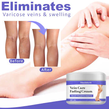 Vein Care Fading Cream