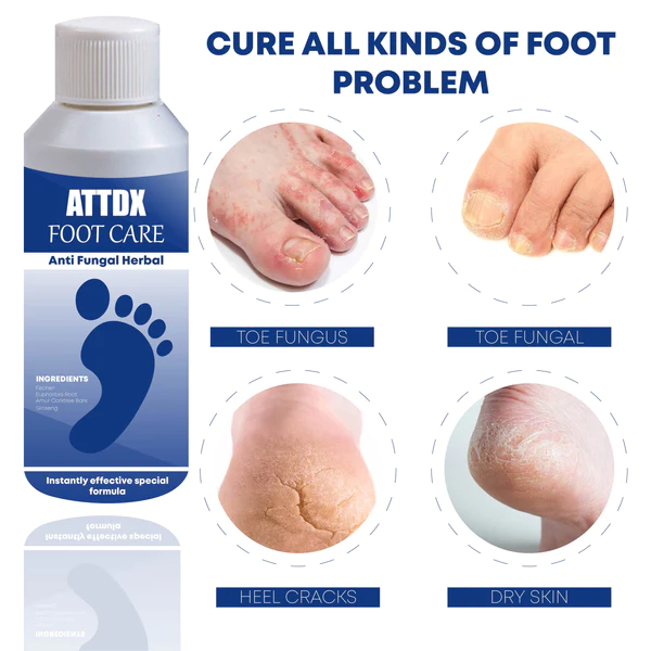 ATTDX FootCare AntiFungal HerbalBath Treatment