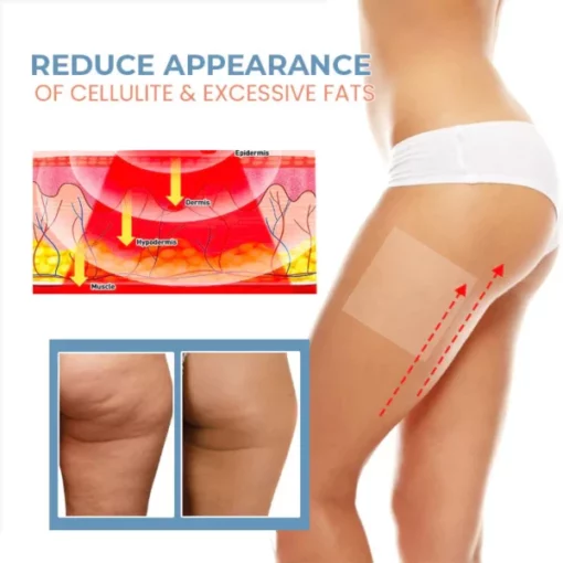 Fivfivgo™ TightenCell Anti-Cellulite Collagen Firming Patches - Image 6