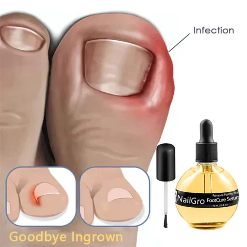 NailGro Intense Nail Growth and Strengthening Removal Paronychia Serum