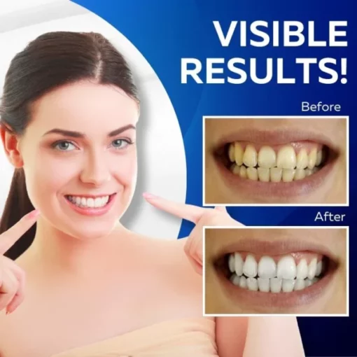 Gleam3D™ Teeth Whitening Strips - Image 4