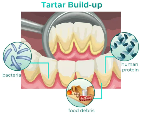 TLOPA Ampoule Oral Restorative Toothpaste to restore the health of your mouth, teeth