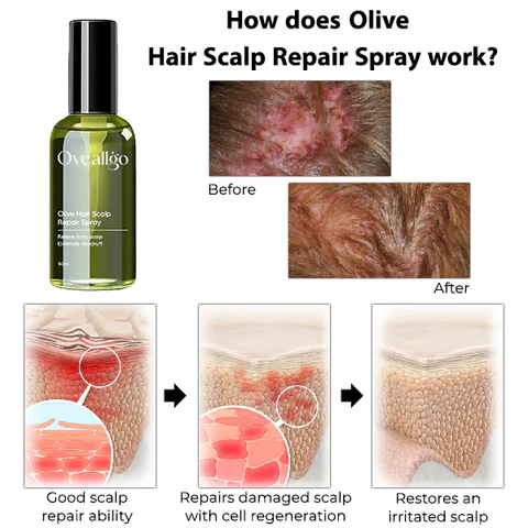 Fivfivgo Olive Hair Scalp Repair Spray