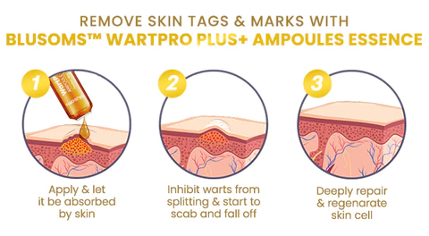 Blusoms WartPro Plus+ Ampoules Essence