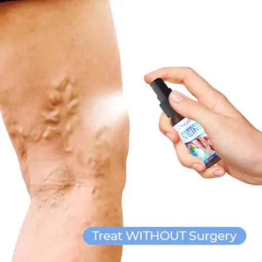 Oveallgo™ Varicose Veins Spray - Image 5