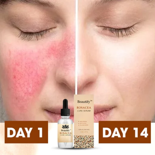 Beautify™ Rosacea Cure Serum - Image 5