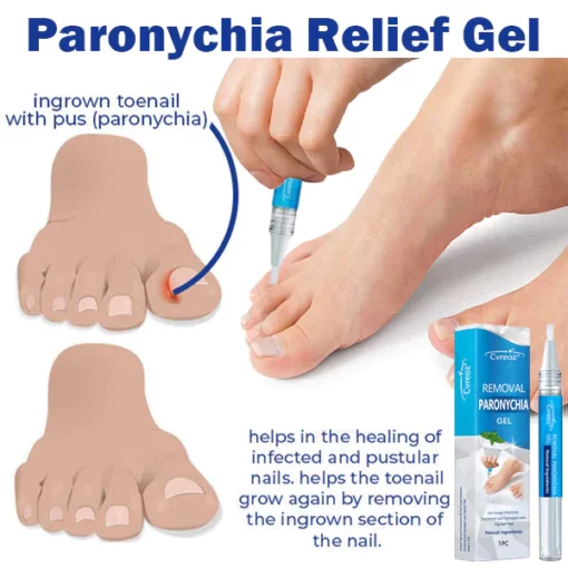 LEFUN Removal Paronychia Gel