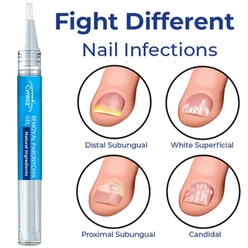 LEFUN Removal Paronychia Gel - Image 2