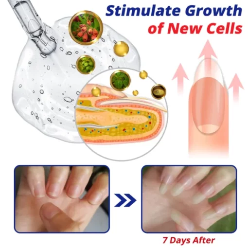 GFOUK™ NailFortify Rapid Growth Treatment Serum - Image 4