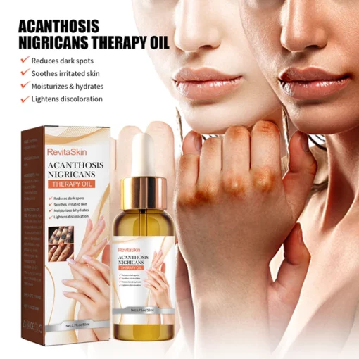 RevitaSkin™ Acanthosis Nigricans Therapy Oil