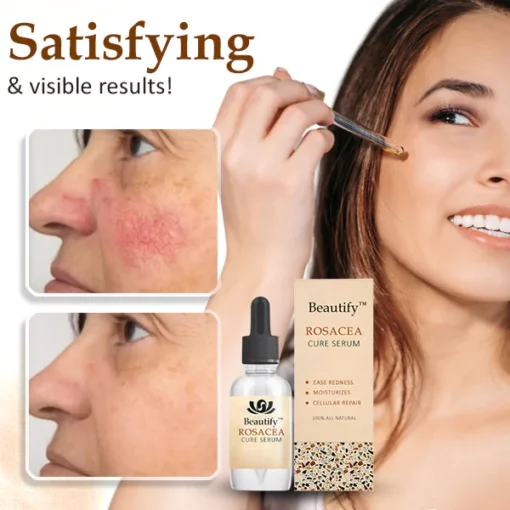 Beautify™ Rosacea Cure Serum - Image 6