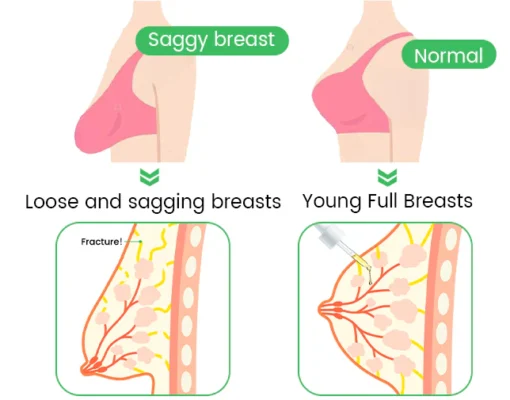 Nurbini™ Lifting Oil For Butt & Breast - Image 6