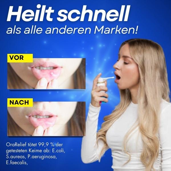 OraRelief Mundgeschwr-Spray