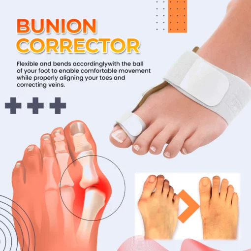 Drto Bunion Splint Correclor