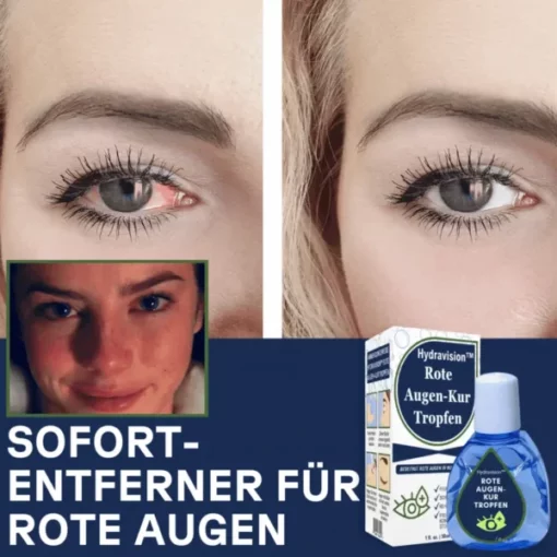 Hydravision™ Rote Augen-Kur Tropfen - Image 4