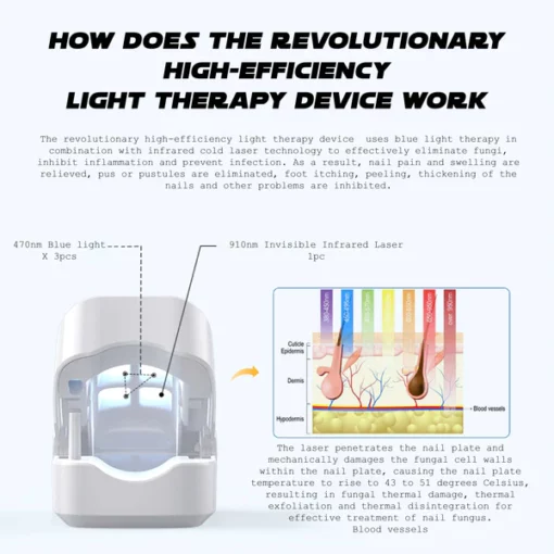 Ricpind NailFungal CleaningLaser TherapeuticDevice - Image 5