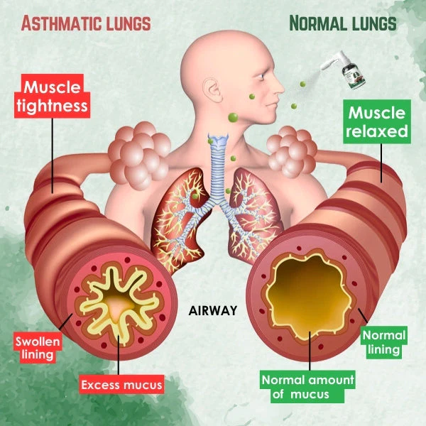 Respira Lung Care Spray