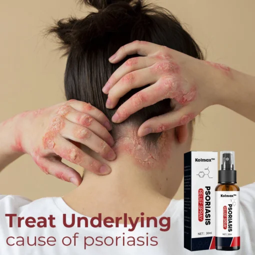 GFOUK™ Kolmax Psoriasis Relief Spray - Image 5