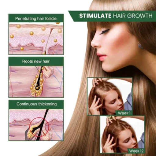 Oveallgo™ PROMAX ScalpRevive Minoxidil Growth Roller - Image 4