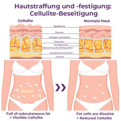 flysmus CelluFirmX Haut-Rebound Verstrkung Pflaster