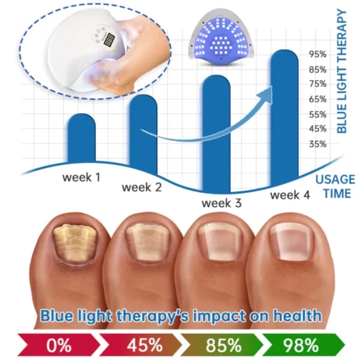 Furzero™ Highly Effective Onychomycosis Machine laser device - Image 5