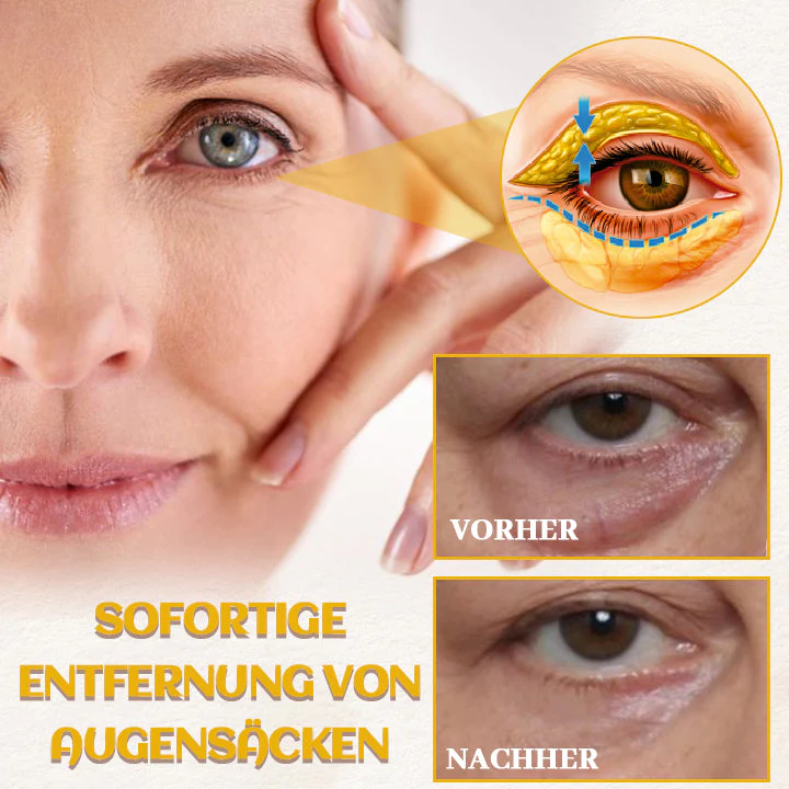 Biancat AgeDefy Rejuven Augen-Essenz