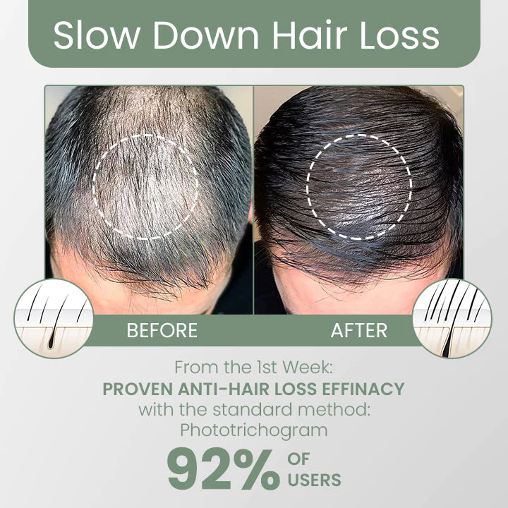 Fivfivgo FolliclePLUS Hair Growth Drops