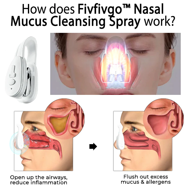 Fivfivgo Nasal Mucus Cleaning Device