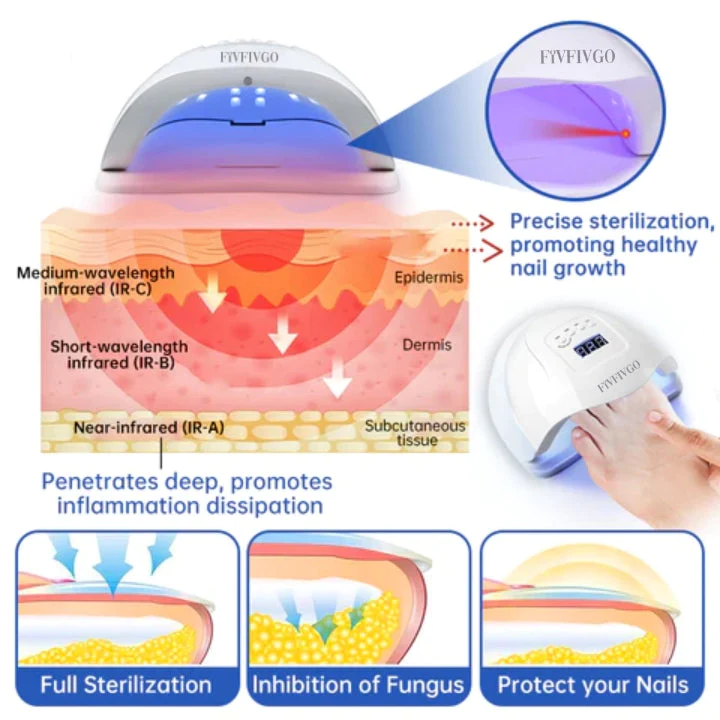 Fivfivgo PureNail Fungus Laser Therapie Ger