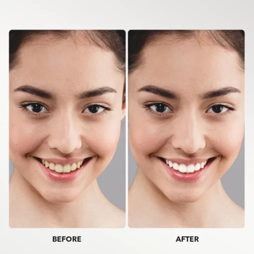 LIMETOW™ Teeth Whitening Powder - Image 5