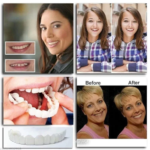 Oveallgo SMILE Adjustable Snap-On Dentures