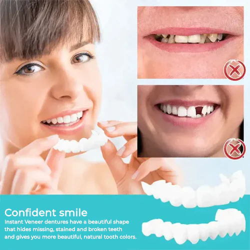 Oveallgo SMILE Adjustable Snap-On Dentures