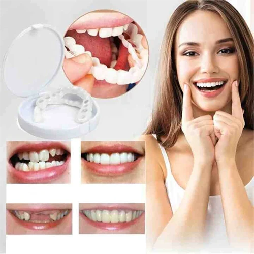 Oveallgo SMILE Adjustable Snap-On Dentures