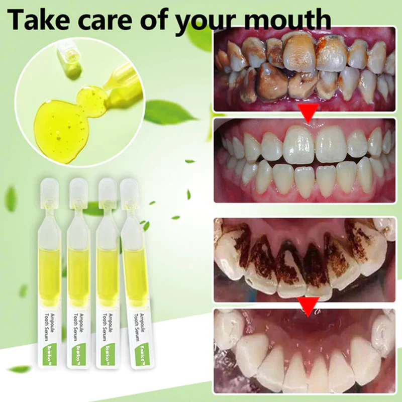 SeuricoWhitening toothpaste essence Removal of tartar and plaque bacteria and various oral problems