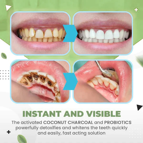 SeuricoWhitening toothpaste essence Removal of tartar and plaque bacteria and various oral problems