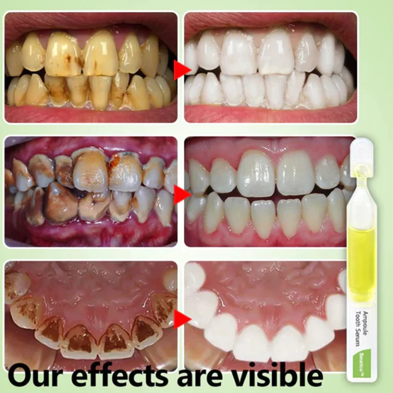 SeuricoWhitening toothpaste essence Removal of tartar and plaque bacteria and various oral problems