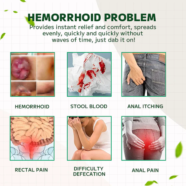 Lotmay Maximum Strength Hemorrhoids and Fissure Ointment