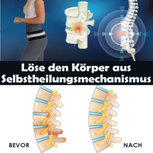 Ricpind SchmerzErleichterung IschiasTherapeutisch Kompression Gürtel - Image 7
