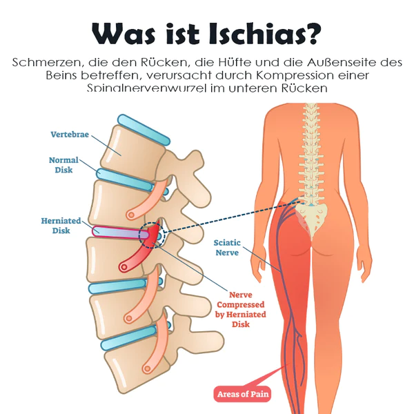 Ricpind SchmerzErleichterung IschiasTherapeutisch Kompression Grtel