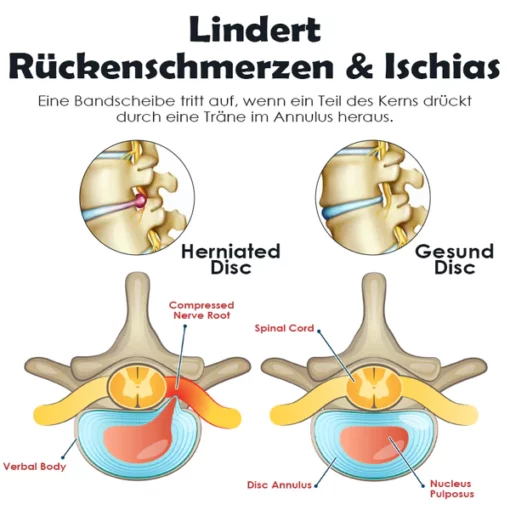 Ricpind SchmerzErleichterung IschiasTherapeutisch Kompression Gürtel - Image 6