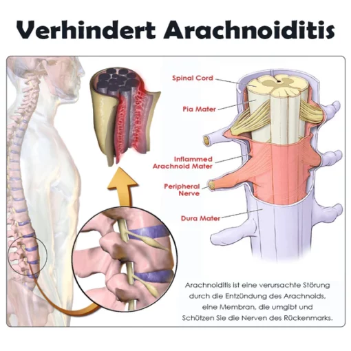 Ricpind SchmerzErleichterung IschiasTherapeutisch Kompression Gürtel - Image 8