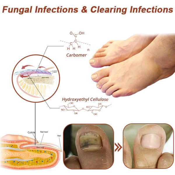 Oveallgo Expert Revolutionary High-Efficiency Light Therapy Device For Toenail Diseases