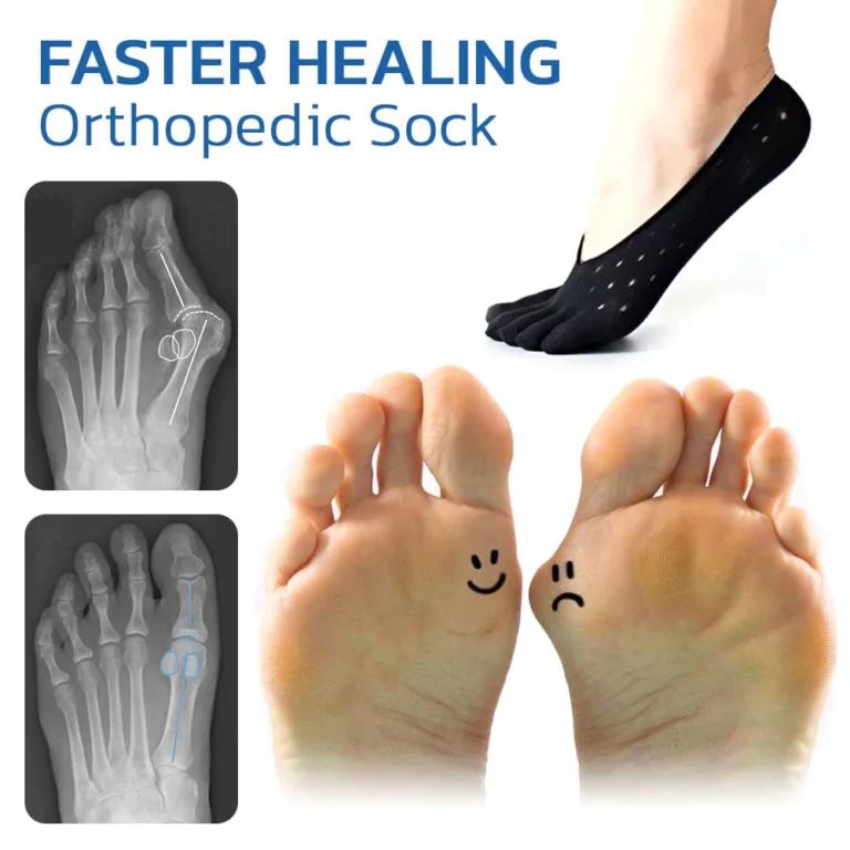 SUPTRUCK Orthopedic Bunion Relief Socks