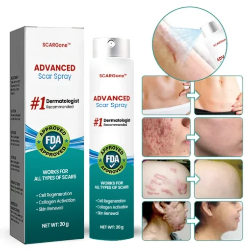 SCARGone™ Advanced Scar Spray - Image 8