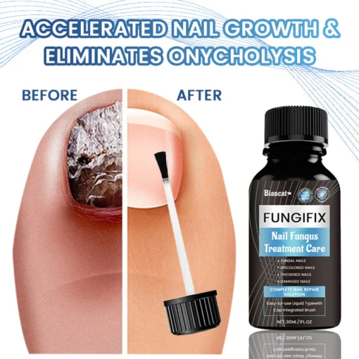 Biancat™ FungiFix Nail Fungus Treatment Care Fluid - Image 6