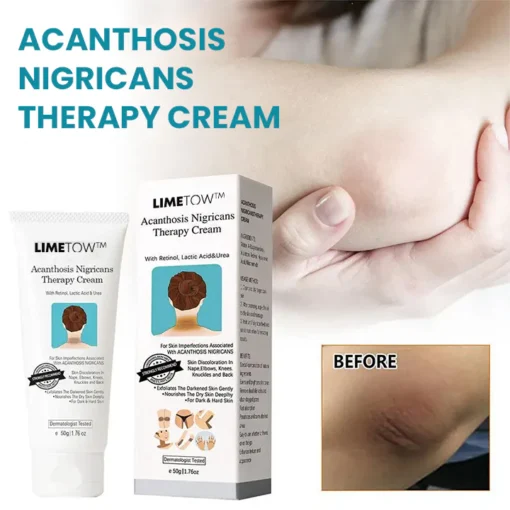 LIMETOW™ Acanthosis Nigricans Therapiecreme - Image 2