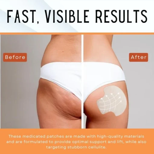 LIMETOW™ Butt-Lift Shaping Pads - Image 3