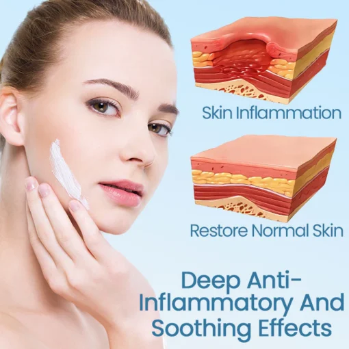 Ceoerty™ Skin Soothing Redness Relief Cream - Image 4