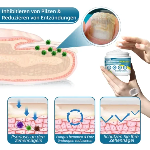 Ourlyard™ Multi-Symptom Psoriasis-Behandlungscreme - Image 6